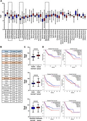 Predictive value analysis of the interaction network of Tks4 scaffold protein in colon cancer